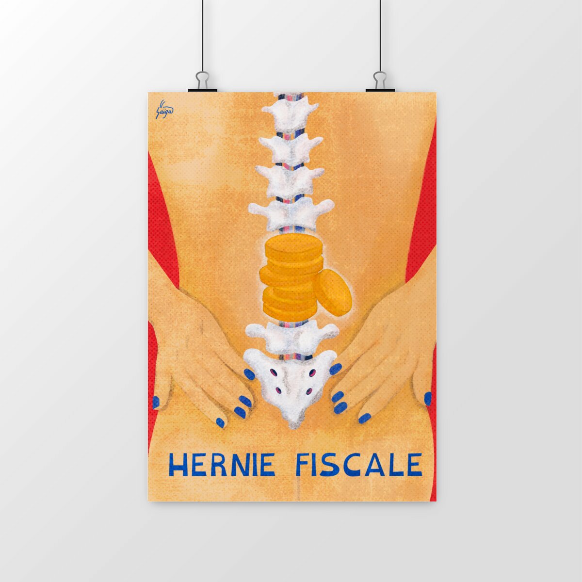 Image front Hernie discale - Hernie fiscale